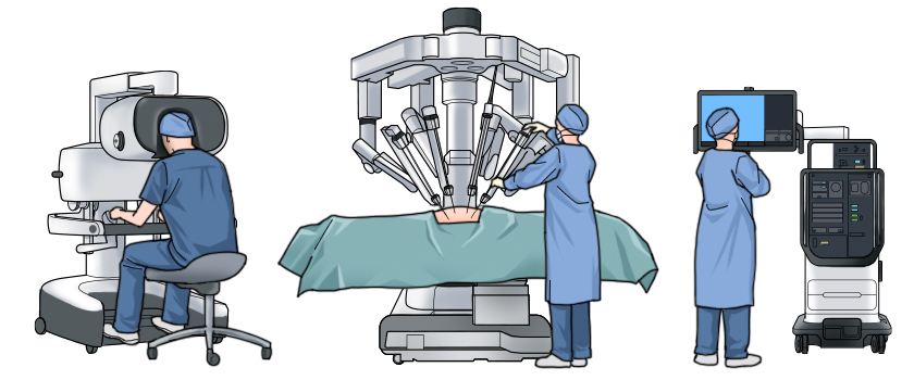 ロボット支援低手術と腹腔鏡手術について